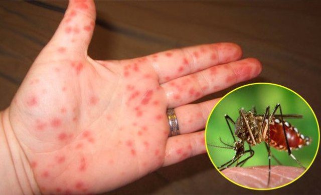 Muỗi là nguyên nhân gây ra nhiều bệnh nguy hiểm